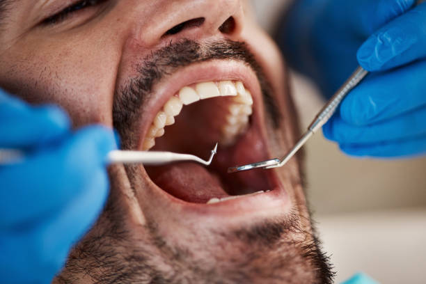 Best Broken Tooth Emergency  in Devon, PA
